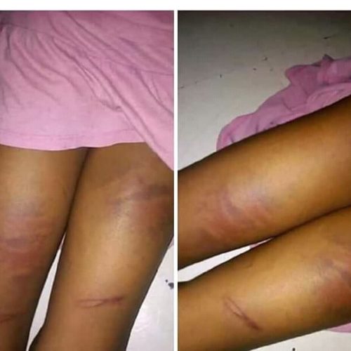 See What A Teacher Did To A Student For Not Completing Her Homework