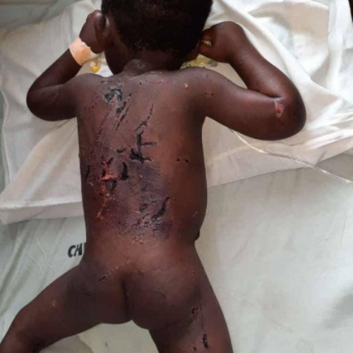 Pure Wickedness!  A Dad Did This To His 3-year-old Son For Bedwetting