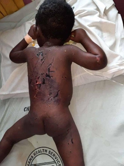 Pure Wickedness!  A Dad Did This To His 3-year-old Son For Bedwetting